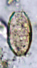 Bild-An egg of a helminth in the borrow of a pit latrine