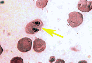 Bild-Babesia canis